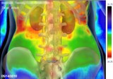 thermal imaging Lower Back overlay